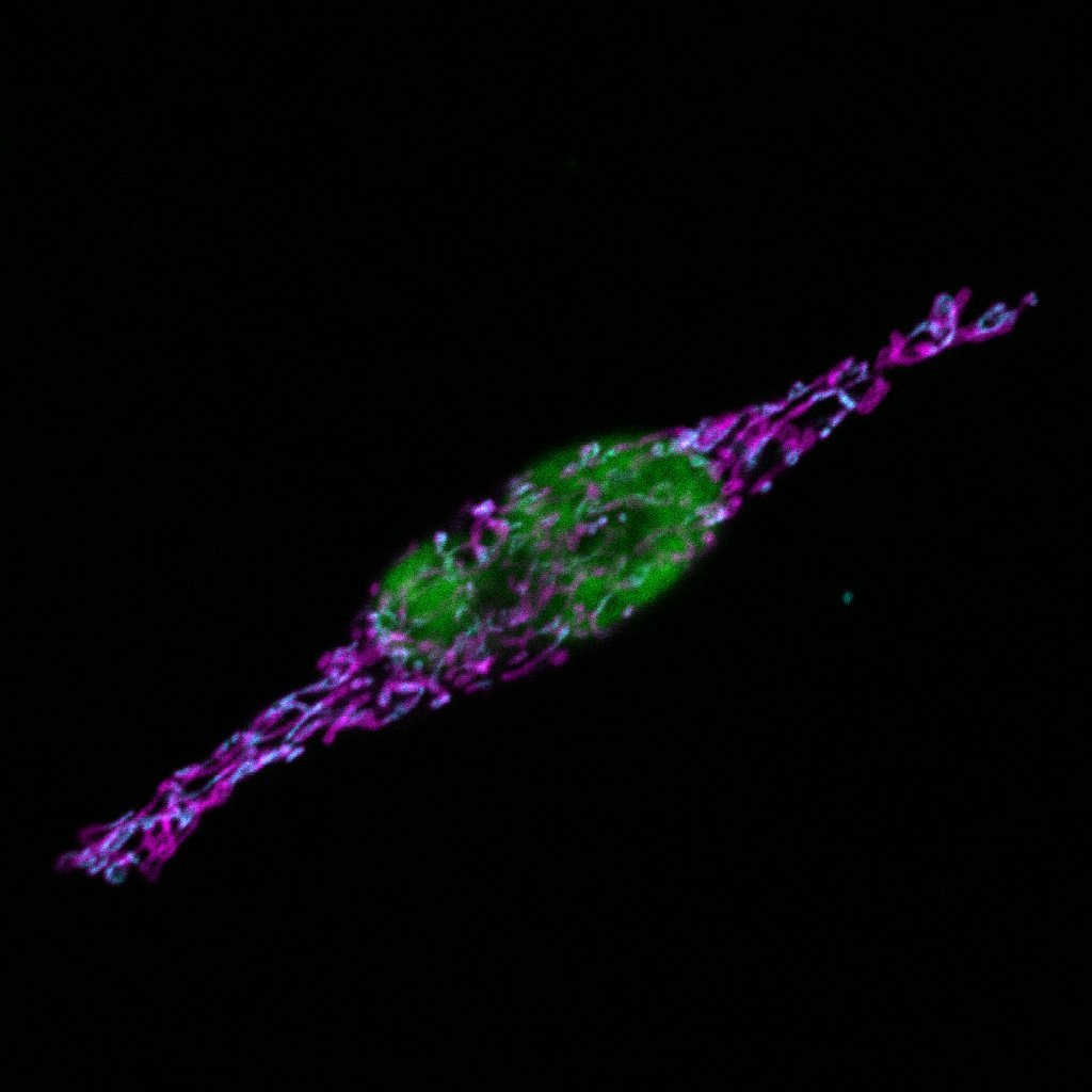 HeLa_FAM-Flag_4_zoom3 composite magenta raw.jpg